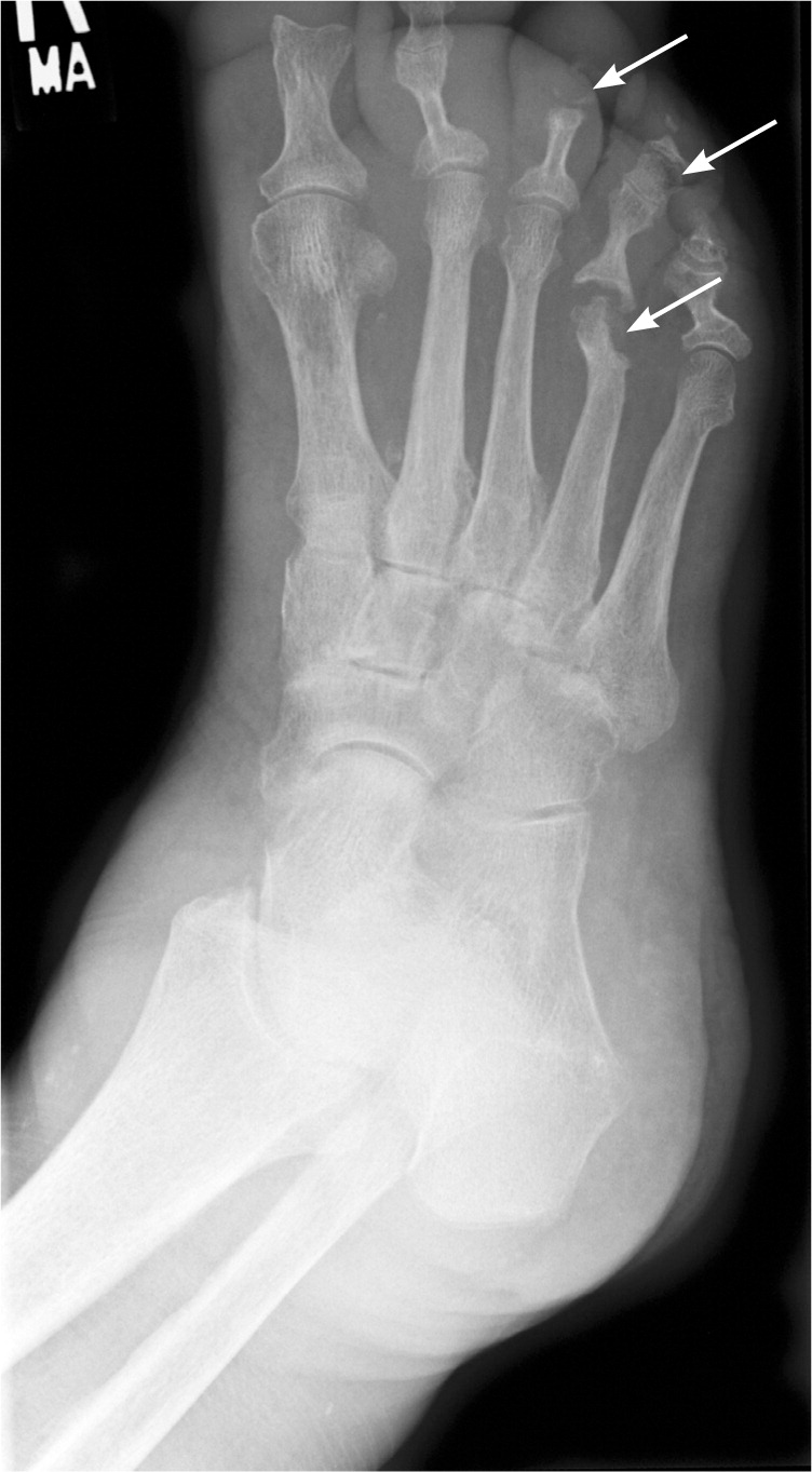 radiograph